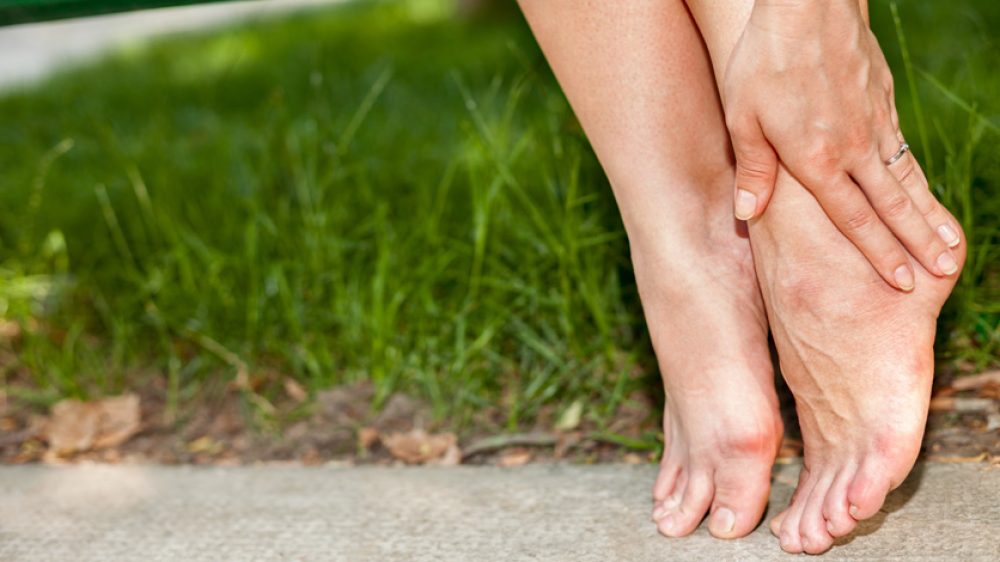 Was tun gegen geschwollene Beine?