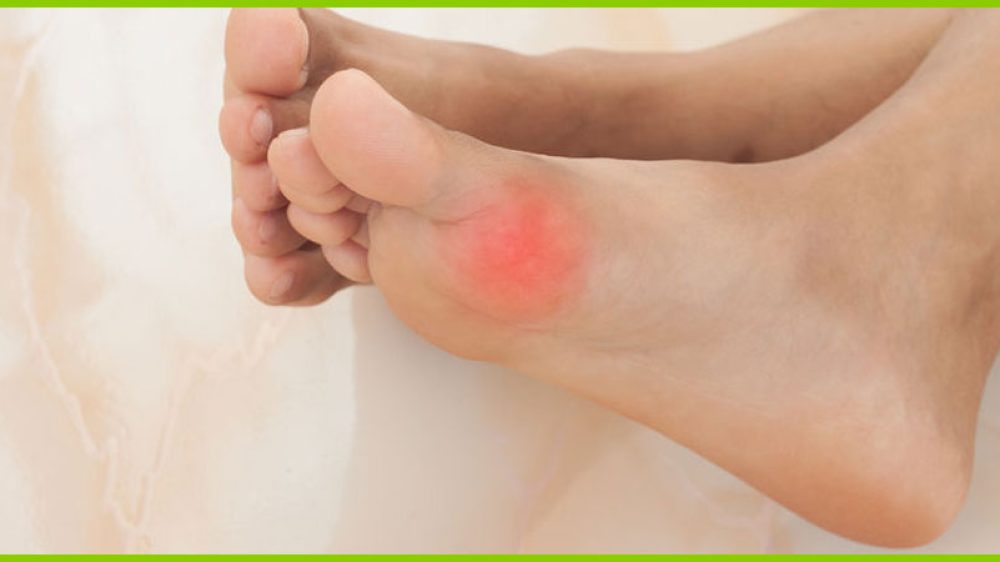 Behandlungsformen von Hallux Valgus