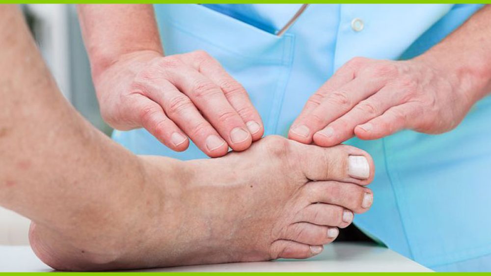 Hallux Valgus Operation und Nachbehandlung