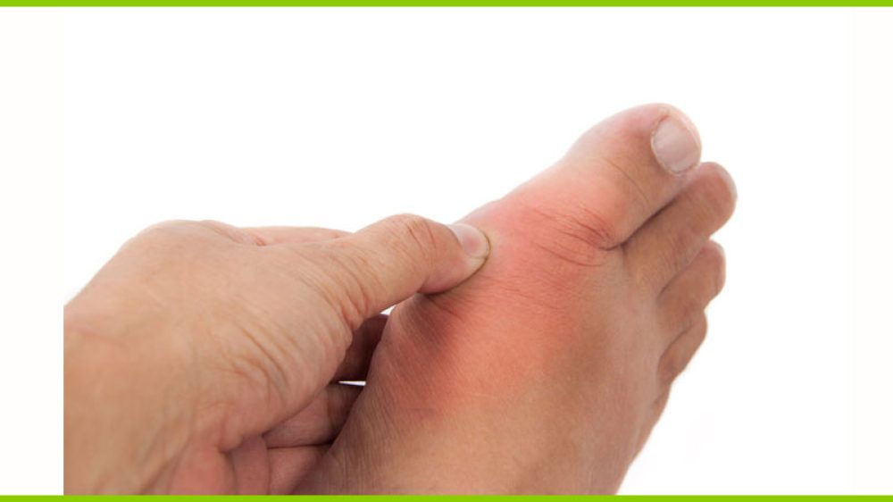 Hallux Valgus Symptome